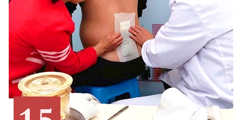 非遗日历｜邓氏颈腰祖传中药疗法