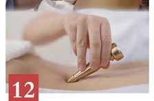 非遗日历｜中医诊疗法（李仲愚杵针疗法）